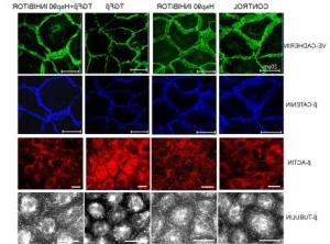 protection-of-enfothelial-cells-by-Hsp90 inhibitors